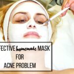 homemade mask for acne