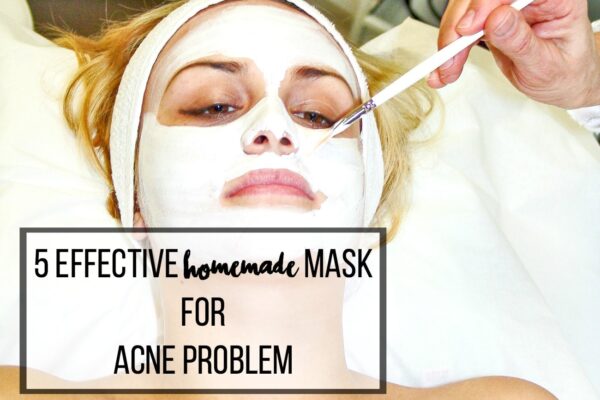 home made masks for acne