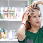 50Megumi-hair-loss-treatment